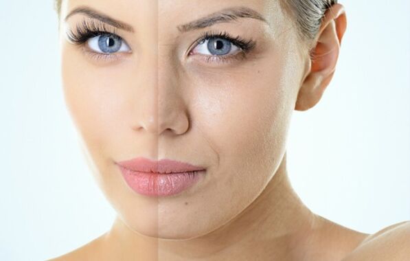 Zatiki gaztetzeko zantzuak